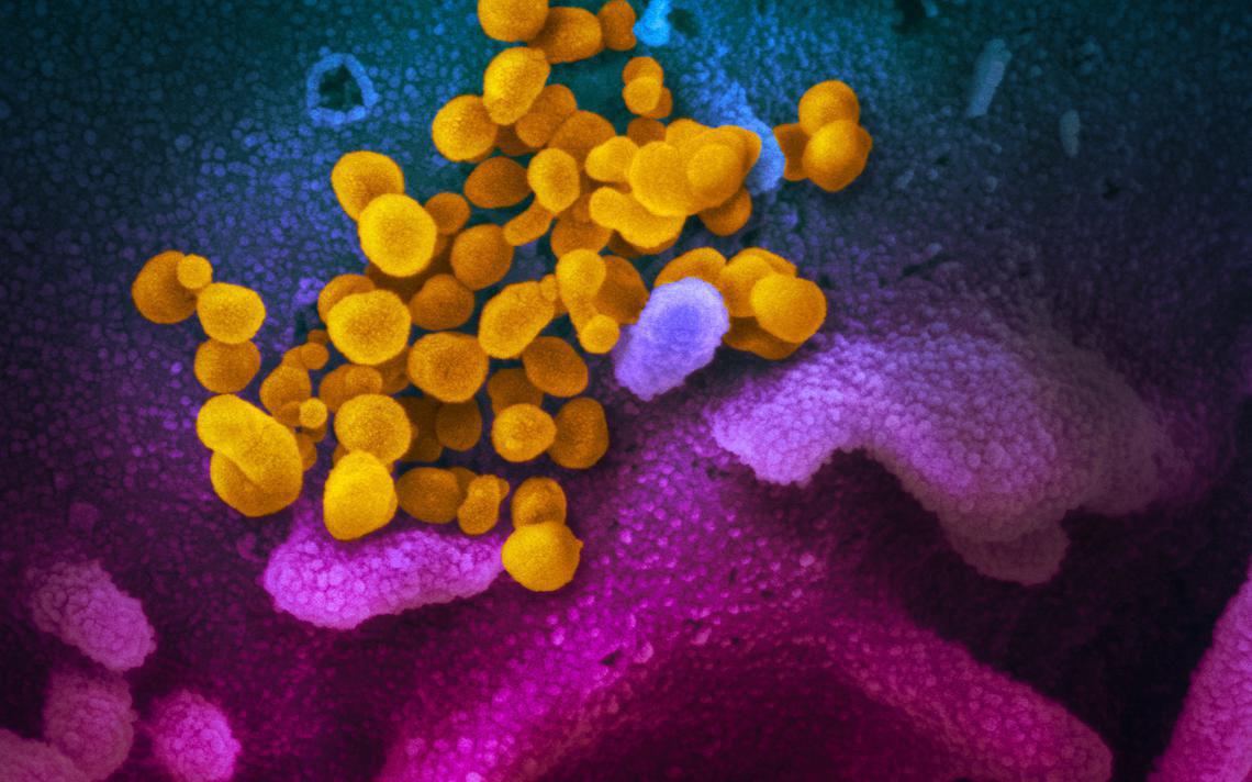 COVID and craigslist