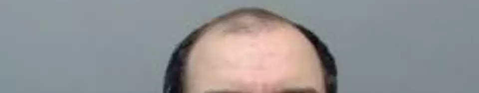 Another Krome-Domed Kik Kreeper