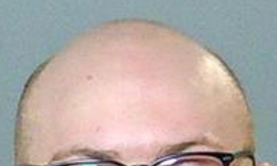 Kik Kreeper Has A Whole Lot of Bald